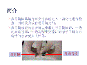 超细胃镜经鼻临床应用.ppt