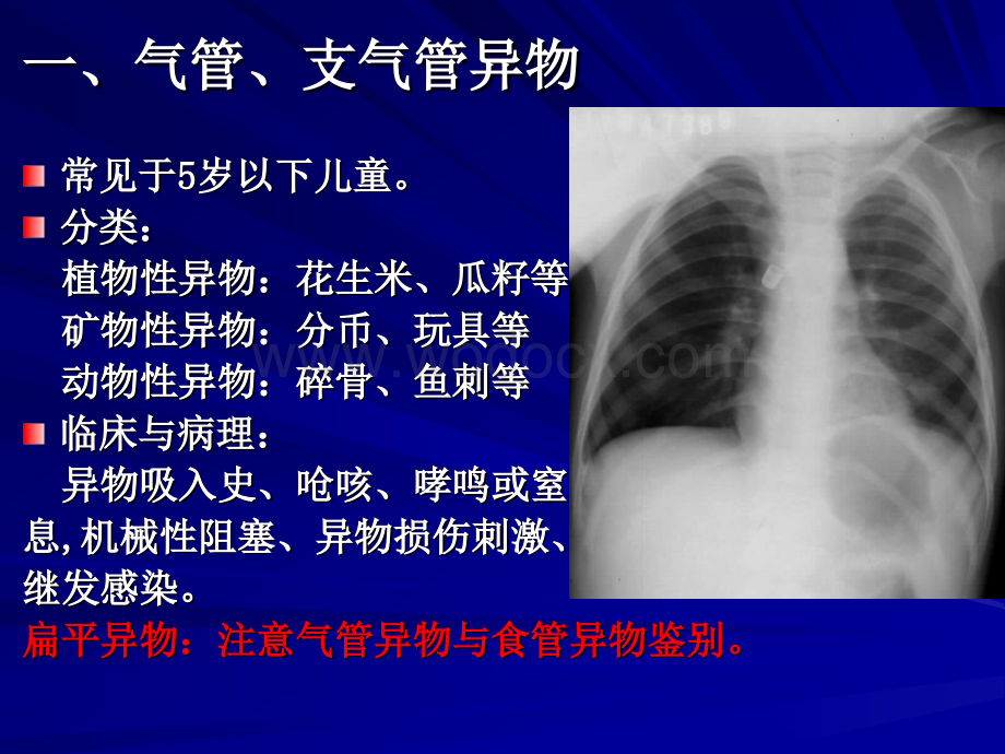 呼吸系统常见疾病影像诊断.ppt_第2页