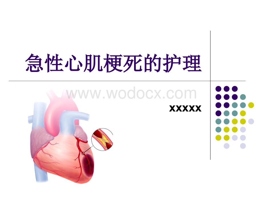 急性心肌梗死护理查房 (2).ppt_第1页