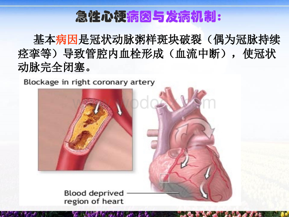 急性心梗溶栓的护理.ppt_第3页