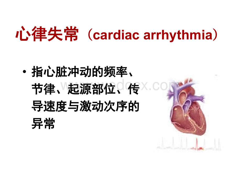 心律失常课件.ppt_第2页