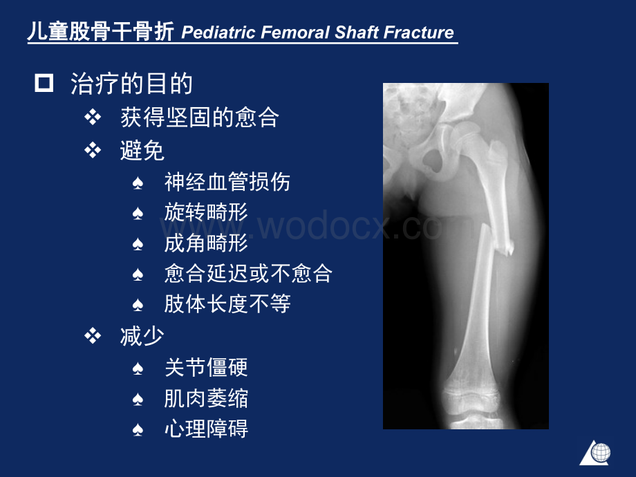 儿童股骨干骨折 课件.PPT_第2页