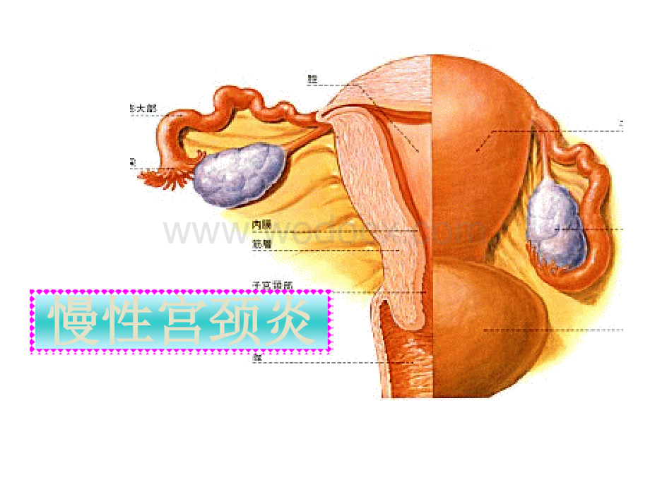 医学课件-慢性宫颈炎_妇产科学课件.ppt_第2页