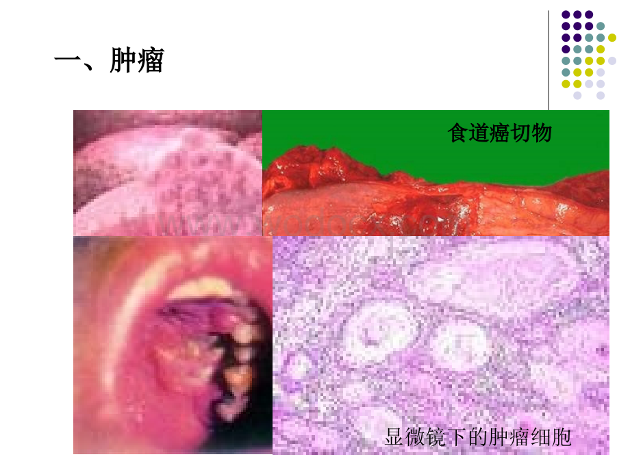 肿瘤、心血管疾病课件.ppt_第2页