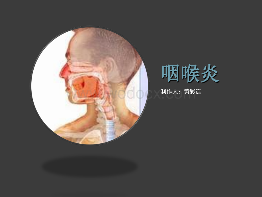 咽喉炎的介绍.ppt_第1页